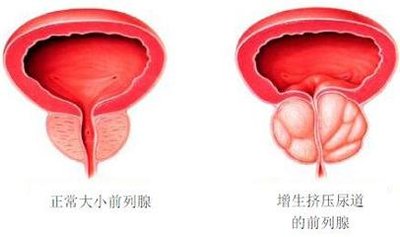 试管婴儿如何判断胚胎好坏？解密试管婴儿胚胎培养的过程