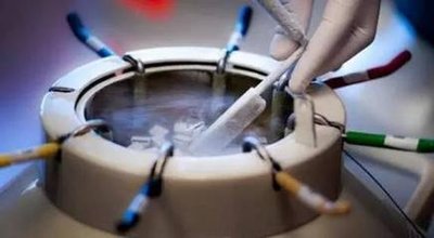 试管知识·提高试管婴儿妊娠胜利率,什么情况下需要做宫腔镜