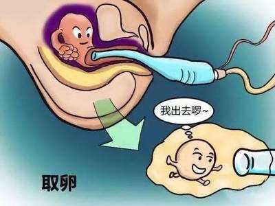 人工授精（IUI）和试管婴儿（IVF）都可以助孕，我选择哪种比拟好