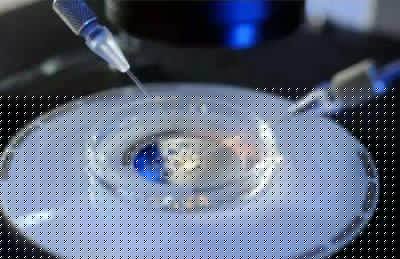 重庆试管婴儿冷生育力保存子