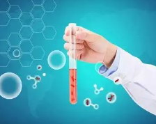 常见疑问·为什么有的人试管婴儿取卵后会有"腹水"