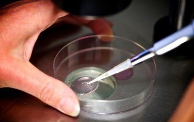 做试管婴儿促排卵后如果出现腹水应该怎么处置?