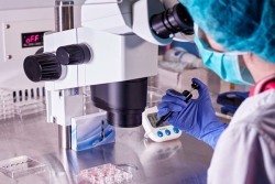 女性患有多囊卵巢的原因有哪些？多囊卵巢做腹腔镜手术治愈率更高？