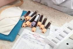 为什么第一代（IVF）试管婴儿会发生受精失败？