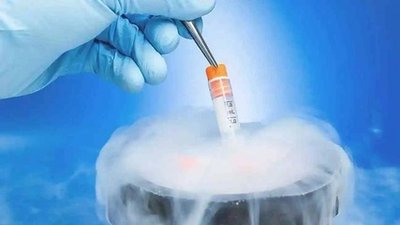 生育力保存也有适应症，女性想要保存生育力可别老想着生育力保存！