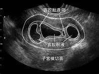 试管婴儿助孕一个医治周期需要多长光阴