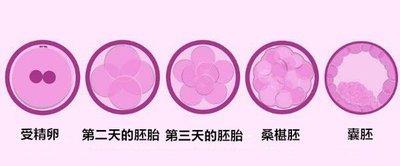 深圳做试管婴儿哪里好