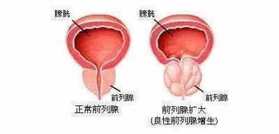 月经周期异常备孕怀不上可以试管婴儿医治吗