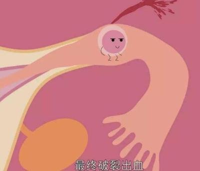 试管医治期间准妈妈们有哪些事情一定需要注意的