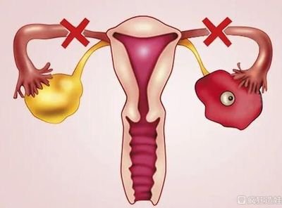 农药会让男性不育吗？从事农业的男性发生不育后可以进行试管婴儿吗