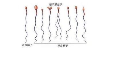 做试管婴儿一次就胜利怀孕大约需要多长光阴