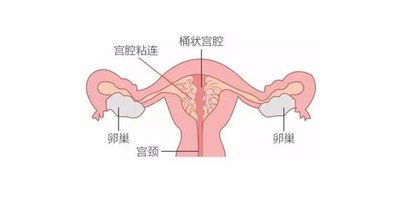 吉尔吉斯斯坦试管流程是怎样