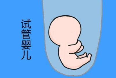 东莞做试管机构选择