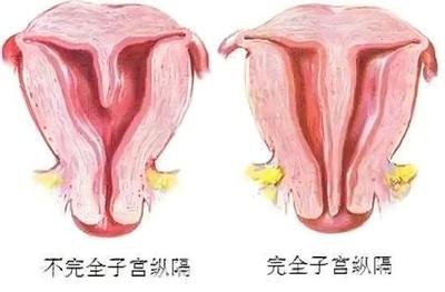 格鲁吉亚试管助孕