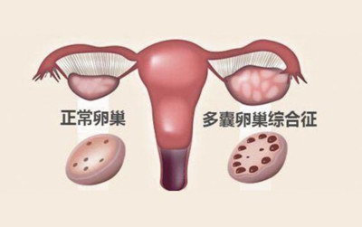 潮州三代试管流程