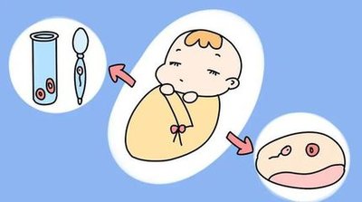 长期久坐有哪些危害试管婴儿助孕要注意什么