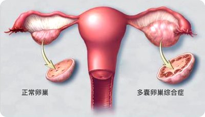 中山单身男性试管多少钱