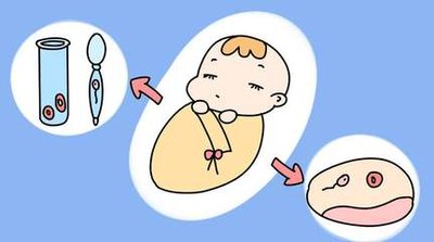 潮州试管机构