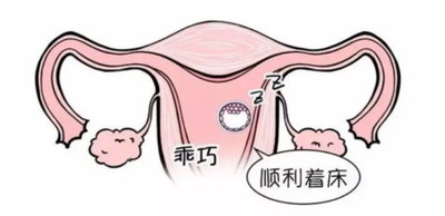 试管婴儿医治中精子、卵子、胚胎是怎么挑选出来的