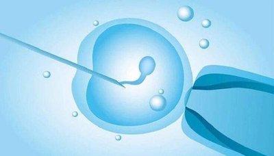 女性不孕后可以做第一代试管婴儿吗