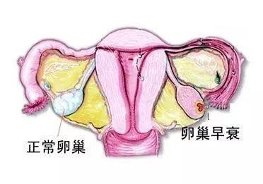 格鲁吉亚三代试管婴儿