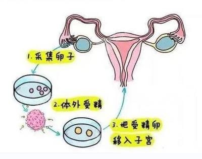 惠州三代试管