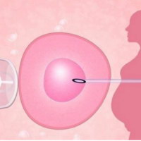 双角子宫还可以试管婴儿生娃吗