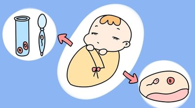 珠海试管之路真实经历