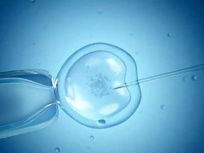 多囊卵巢综合征（PCOS）难孕可以选择试管婴儿助孕吗