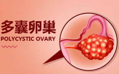 格鲁吉亚试管婴儿水平