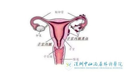 深圳试管婴儿胚胎移植后多久着床