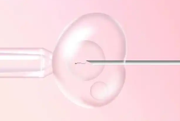 在深圳做试管婴儿的费用概览与考量