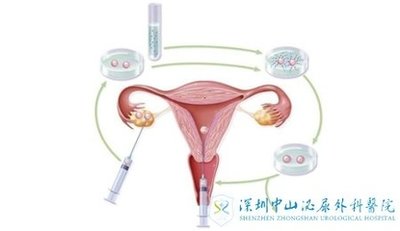 90后来深圳做试管婴儿也要查看吗