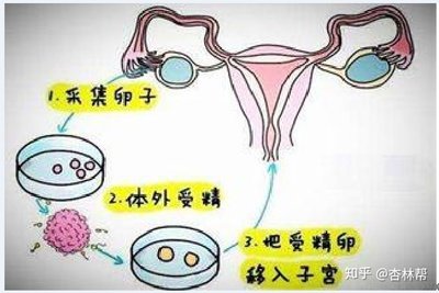 男性患有弱精子症生育难试管婴儿期间要注意什么