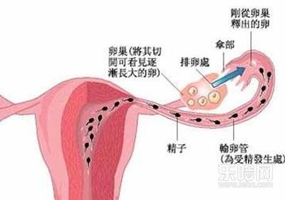 试管婴儿助孕输卵管积水怎么办对怀孕会不会有什么影响