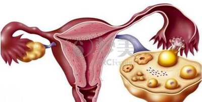女性难孕卵泡发育不良能不能试管婴儿助孕生娃