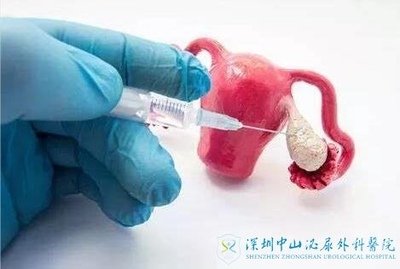 试管婴儿助孕过程取卵术前的注意事项有哪些