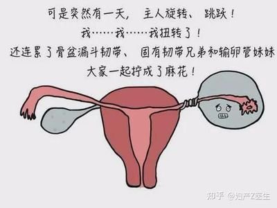 试管婴儿辅助生育卵巢扭转是如何发生的