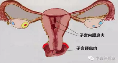 宫颈息肉有症状吗试管婴儿辅助生育可以胜利吗