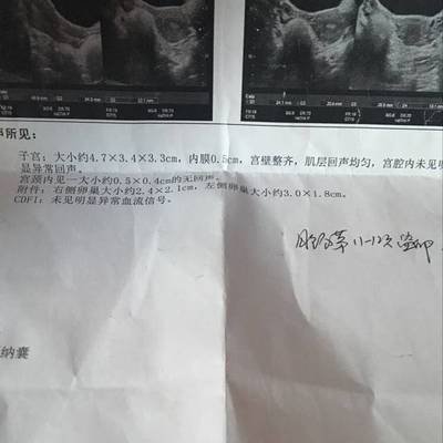 输卵管不通的话，还能排卵吗