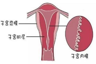 试管医治中胚胎和内膜不好会导致助孕失败吗