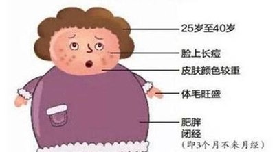 卵巢多囊有什么危害