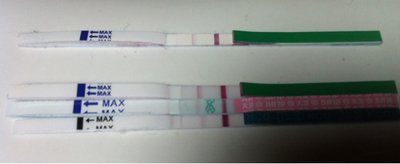 卵巢畸胎瘤在试管婴儿取卵的时候需要切除吗